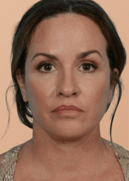 Facenique